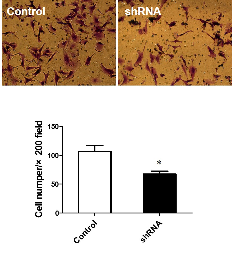 Transwell服務(wù)(圖1)